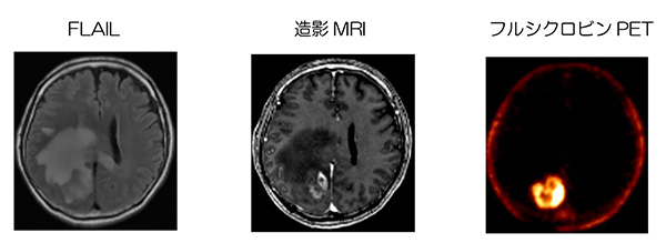 フルシクロビンPETのイメージ
